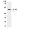 Western blot analysis of the lysates from HT-29 cells using ACHE antibody.