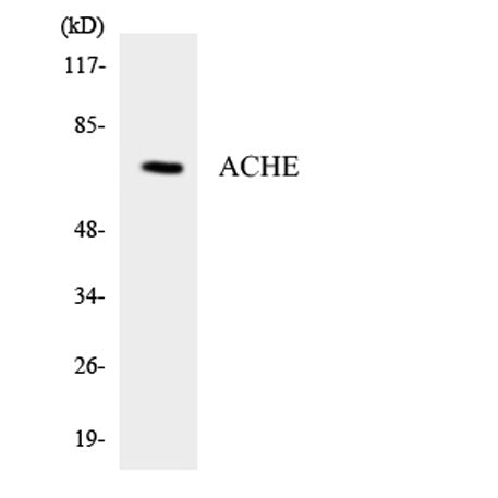 Western blot analysis of the lysates from HT-29 cells using ACHE antibody.