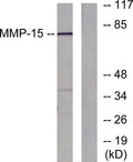 Western blot analysis of lysates from MDA-MB-435 cells, using MMP-15 Antibody. The lane on the right is blocked with the synthesized peptide.