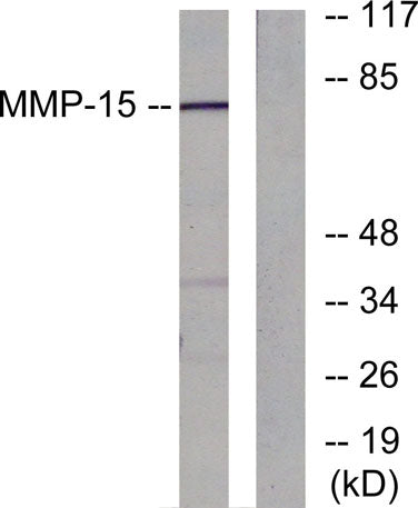 Western blot analysis of lysates from MDA-MB-435 cells, using MMP-15 Antibody. The lane on the right is blocked with the synthesized peptide.