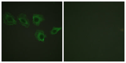 MYPT1 (phospho Thr696) rabbit pAb – Figure 1 of 2