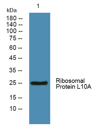 Ribosomal Protein L10A rabbit pAb – Figure 1 of 2