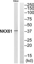 Western blot analysis of NKX61 Antibody. The lane on the right is blocked with the NKX61 peptide.