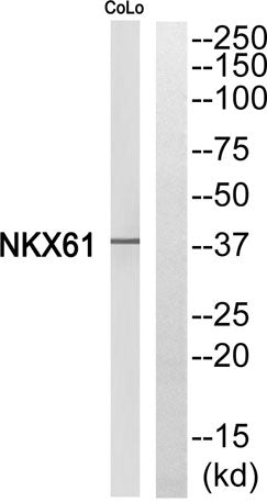 Western blot analysis of NKX61 Antibody. The lane on the right is blocked with the NKX61 peptide.