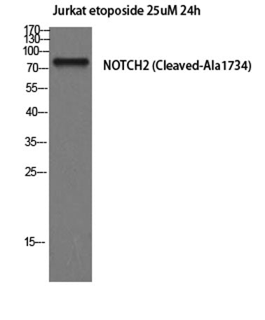 Western Blot analysis of Jurkat cells using Cleaved-Notch 2 (A1734) Polyclonal Antibody diluted at 1:2000