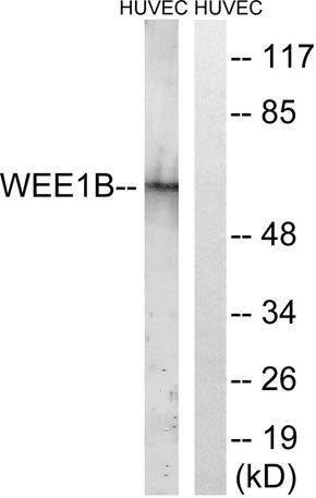 Western blot analysis of lysates from HUVEC cells, using WEE2 Antibody. The lane on the right is blocked with the synthesized peptide.