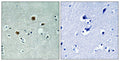PAKβ rabbit pAb – Figure 1 of 3