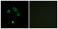 Immunofluorescence analysis of MCF7 cells, using TAS2R13 Antibody. The picture on the right is blocked with the synthesized peptide.