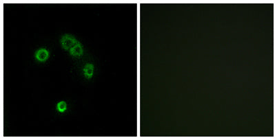 Immunofluorescence analysis of MCF7 cells, using TAS2R13 Antibody. The picture on the right is blocked with the synthesized peptide.
