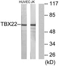 TBX22 rabbit pAb – Figure 1 of 2