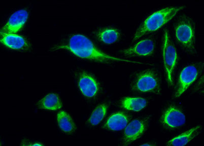 PDGF-B rabbit pAb – Figure 1 of 4