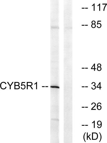 Western blot analysis of lysates from RAW264.7 cells, using CYB5R1 Antibody. The lane on the right is blocked with the synthesized peptide.