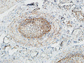 Immunohistochemical analysis of paraffin-embedded Human testis. 1, Antibody was diluted at 1:100(4° overnight).  2, High-pressure and temperature EDTA, pH8.0 was used for antigen retrieval. 3,Secondary antibody was diluted at 1:200(room temperature, 30min).