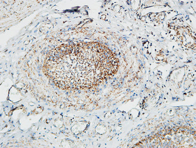 Immunohistochemical analysis of paraffin-embedded Human testis. 1, Antibody was diluted at 1:100(4° overnight).  2, High-pressure and temperature EDTA, pH8.0 was used for antigen retrieval. 3,Secondary antibody was diluted at 1:200(room temperature, 30min).