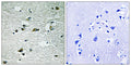 Casein Kinase Iγ1/2/3 (phospho Tyr263) rabbit pAb – Figure 1 of 1