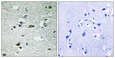 Casein Kinase Iγ1/2/3 (phospho Tyr263) rabbit pAb – Figure 1 of 1