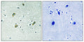 Casein Kinase Iγ1/2/3 rabbit pAb – Figure 1 of 1