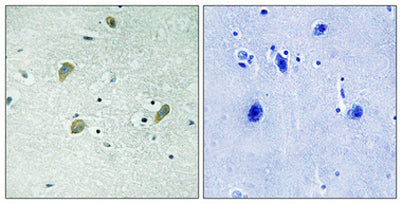 Casein Kinase Iγ1/2/3 rabbit pAb – Figure 1 of 1