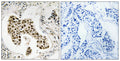 PMS2/PMS2CL rabbit pAb – Figure 1 of 1