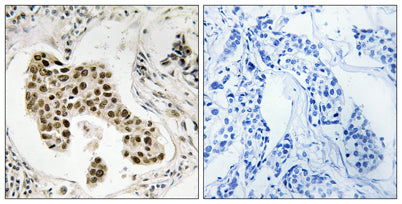 PMS2/PMS2CL rabbit pAb – Figure 1 of 1