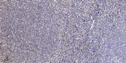 CROT rabbit pAb – Figure 1 of 1