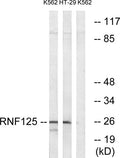 TRAC-1 rabbit pAb – Figure 1 of 2