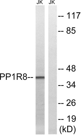 Western blot analysis of lysates from Jurkat cells, using PPP1R8 Antibody. The lane on the right is blocked with the synthesized peptide.