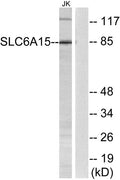 Western blot analysis of lysates from Jurkat cells, using SLC6A15 Antibody. The lane on the right is blocked with the synthesized peptide.