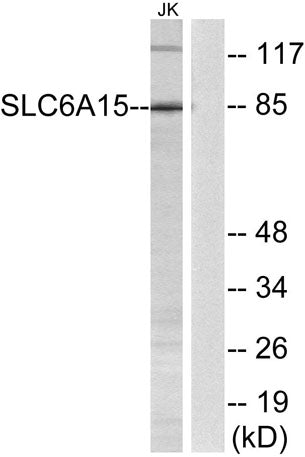 Western blot analysis of lysates from Jurkat cells, using SLC6A15 Antibody. The lane on the right is blocked with the synthesized peptide.