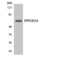 Western blot analysis of the lysates from HeLa cells using PPP2R5A antibody.