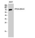 Western Blot analysis of 293T cells using PP2A-B56-δ Polyclonal Antibody diluted at 1:1000