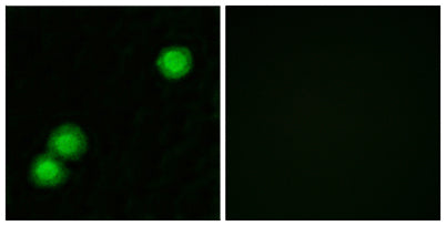 PKI β rabbit pAb – Figure 1 of 2