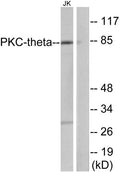PKC θ rabbit pAb – Figure 1 of 1