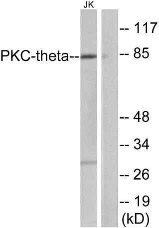 PKC θ rabbit pAb – Figure 1 of 1