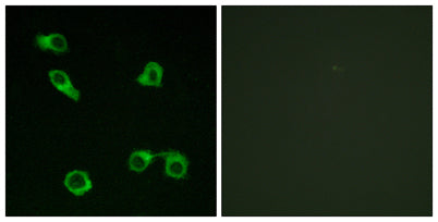 Immunofluorescence analysis of COS7 cells, using PE2R3 Antibody. The picture on the right is blocked with the synthesized peptide.
