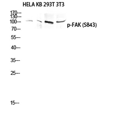 FAK (phospho Ser843) rabbit pAb – Figure 1 of 3