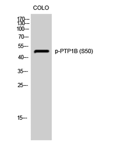 Western Blot analysis of COLO cells using Phospho-PTP1B (S50) Polyclonal Antibody diluted at 1:500