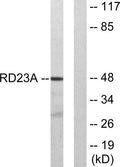 Western blot analysis of lysates from LOVO cells, using RAD23A Antibody. The lane on the right is blocked with the synthesized peptide.
