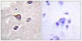 GRK 1 (phospho Ser21) rabbit pAb – Figure 1 of 2