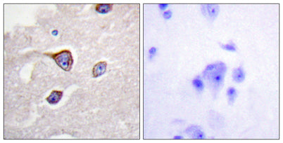 GRK 1 (phospho Ser21) rabbit pAb – Figure 1 of 2