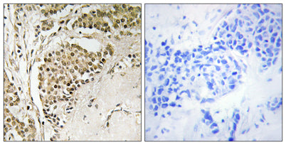 NOM1 rabbit pAb – Figure 1 of 1