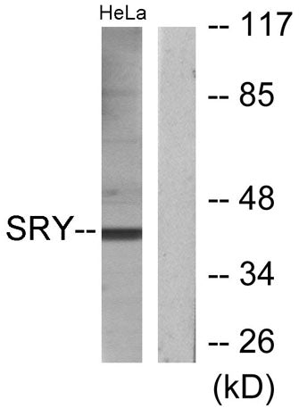 SRY rabbit pAb – Figure 1 of 3