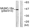 Western blot analysis of lysates from COS7 cells treated with PMA 125ng/ml 30', using MUNC-18a (Phospho-Ser313) Antibody. The lane on the right is blocked with the phospho peptide.