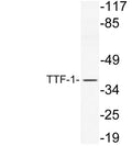 Western blot analysis of lysate from NIH/3T3 cells, using TTF-1 antibody.