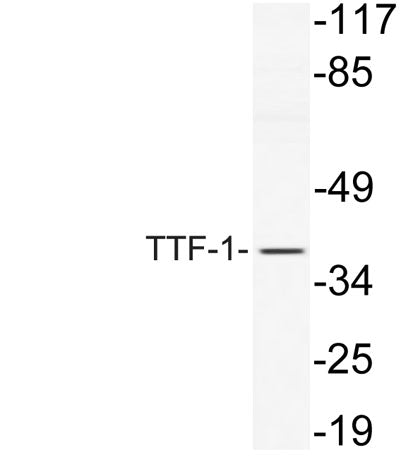Western blot analysis of lysate from NIH/3T3 cells, using TTF-1 antibody.