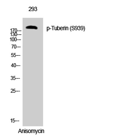 Western Blot analysis of 293 cells using Phospho-Tuberin (S939) Polyclonal Antibody