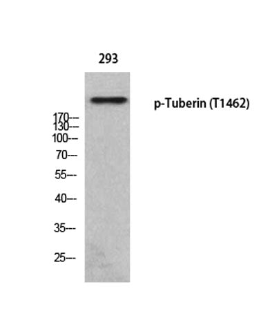 Western blot analysis of 293 using p-Tuberin (T1462) antibody.