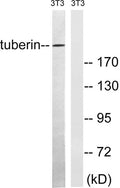 Western blot analysis of lysates from NIH/3T3 cells, using Tuberin Antibody. The lane on the right is blocked with the synthesized peptide.
