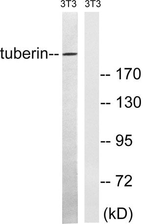 Western blot analysis of lysates from NIH/3T3 cells, using Tuberin Antibody. The lane on the right is blocked with the synthesized peptide.