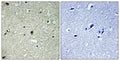HIRA (phospho Thr555) rabbit pAb – Figure 1 of 2